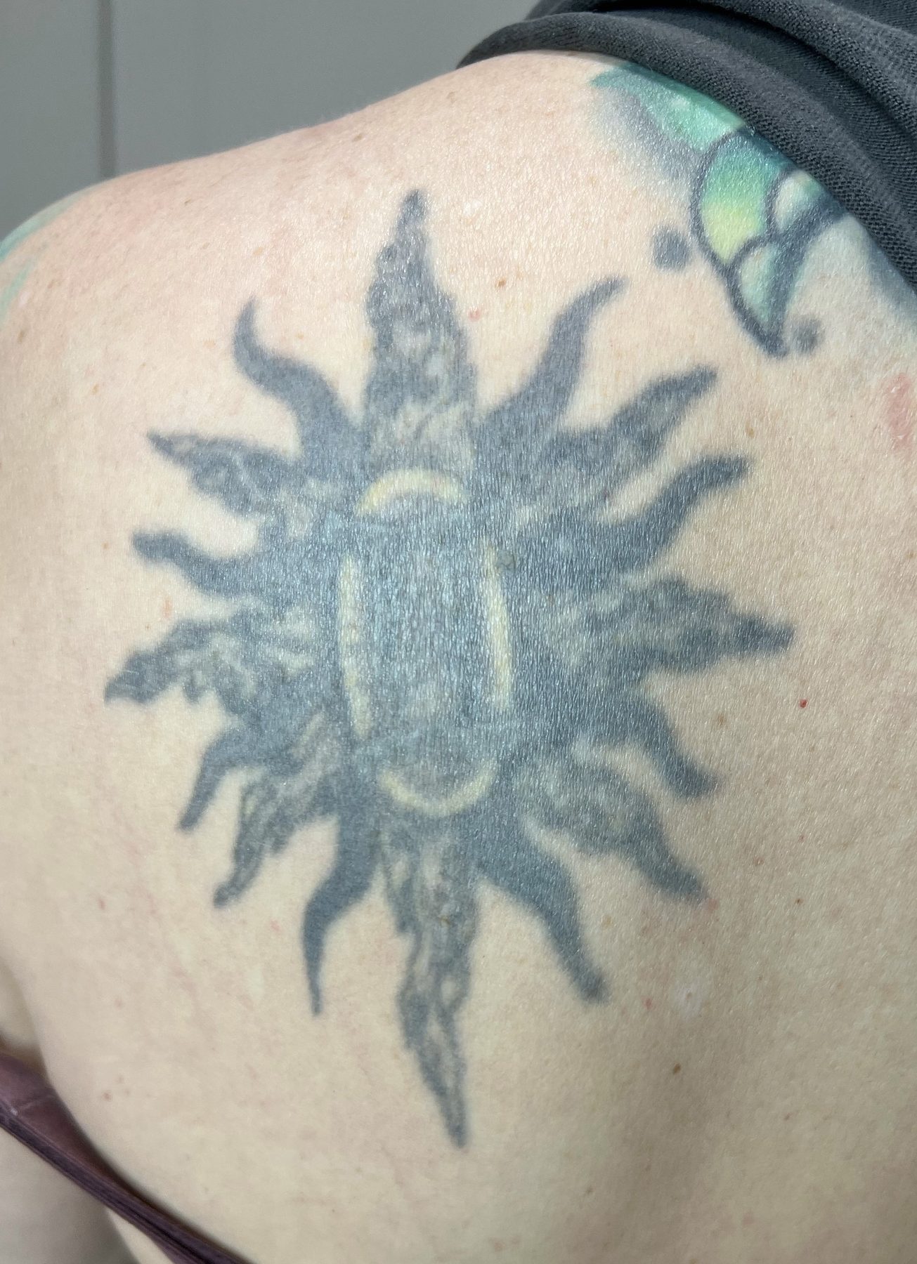 Tattoo before laser tattoo removal at Goodbye Rhonda