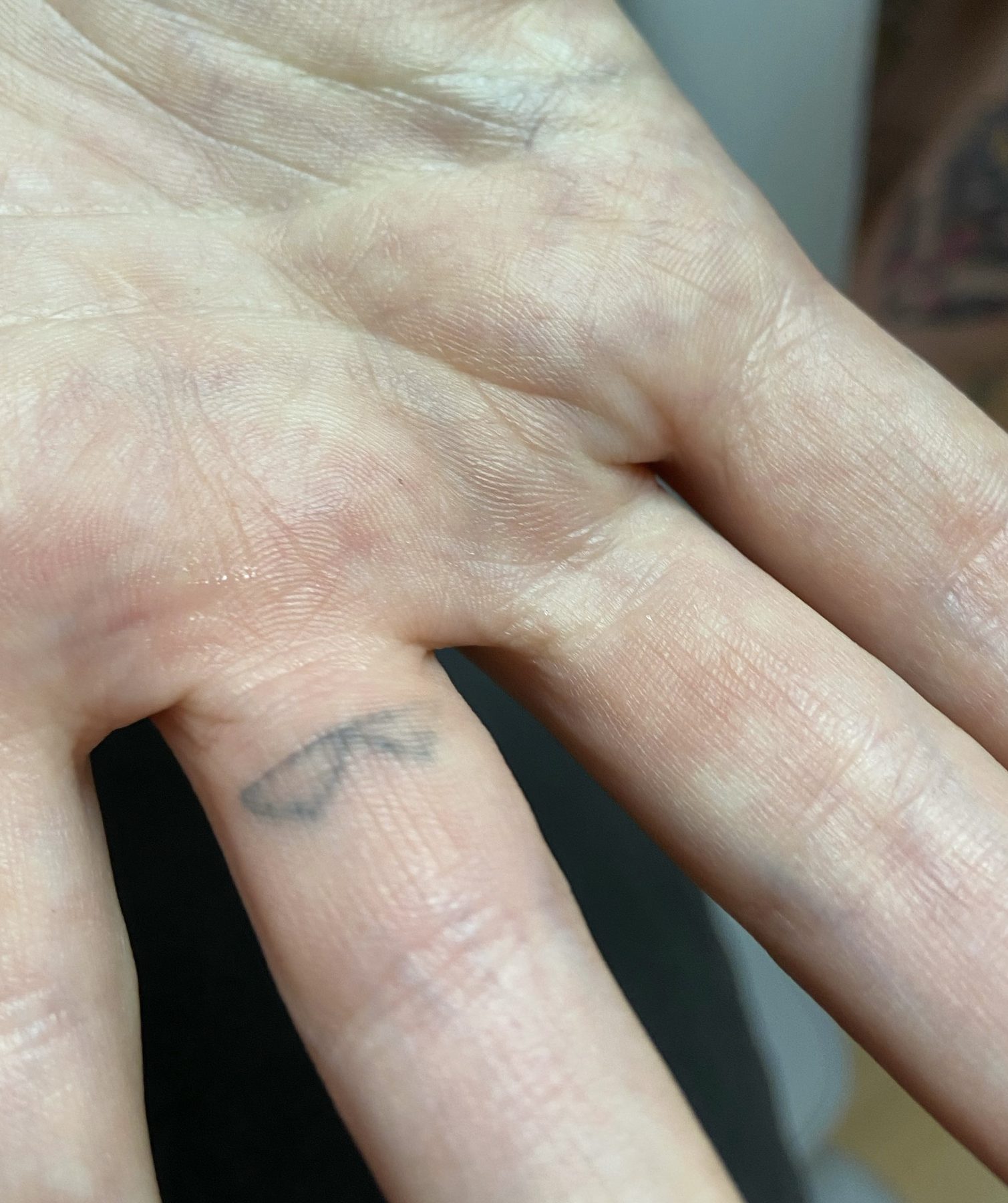 Tattoo before laser tattoo removal at Goodbye Rhonda