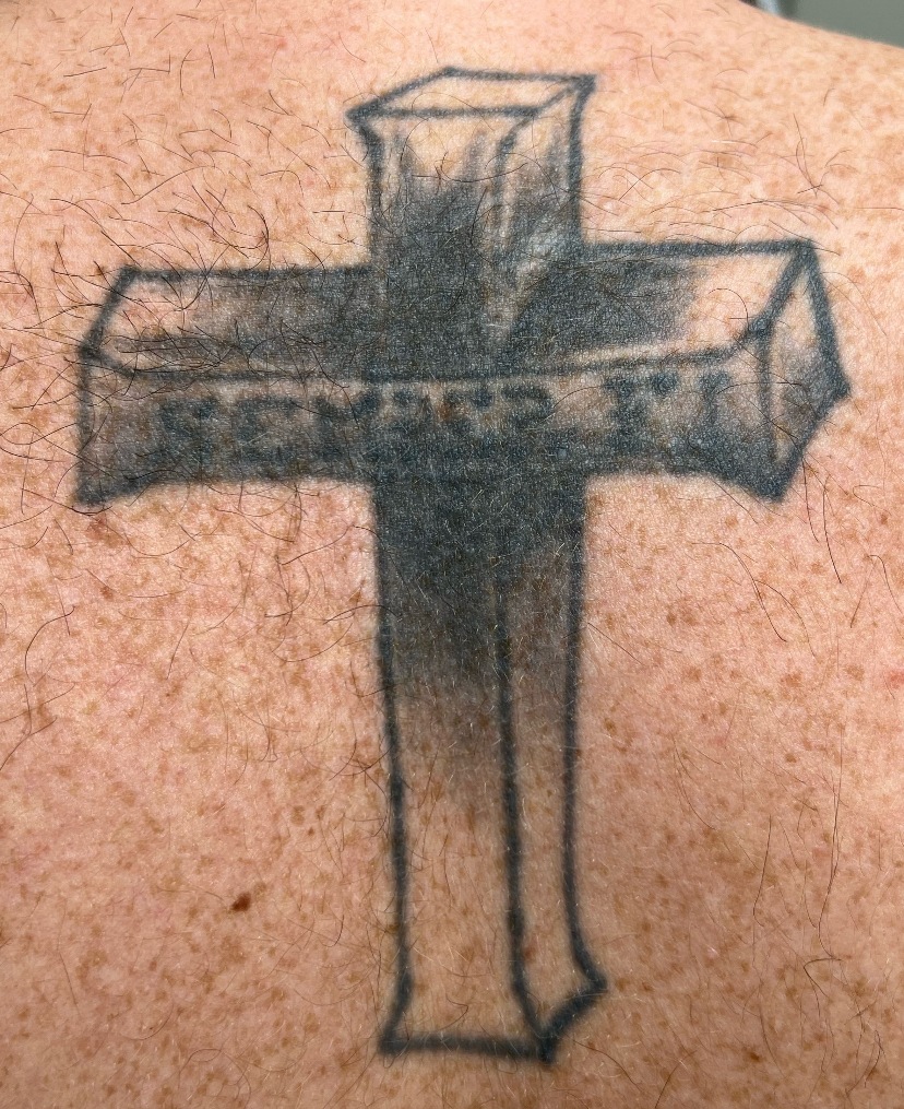 Tattoo before laser tattoo removal at Goodbye Rhonda