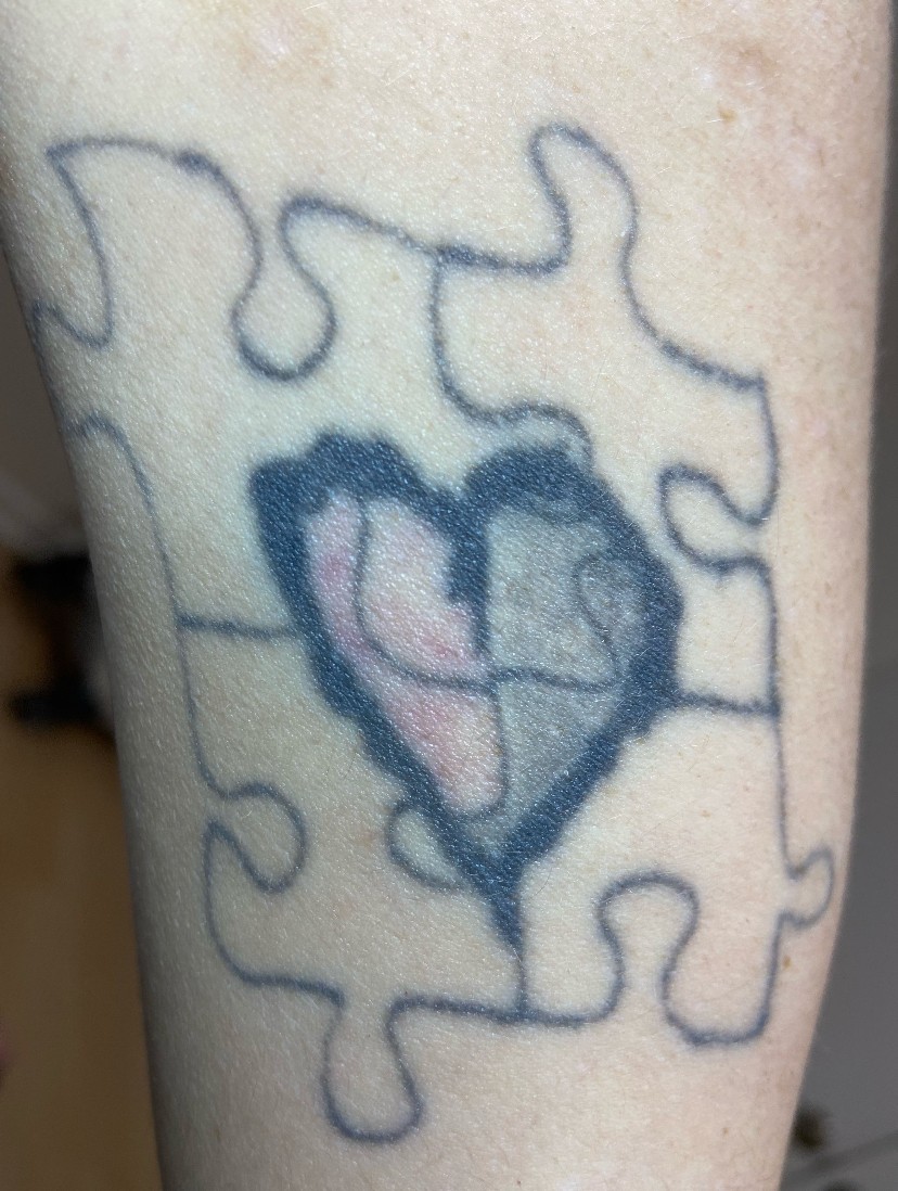 Tattoo before laser tattoo removal at Goodbye Rhonda