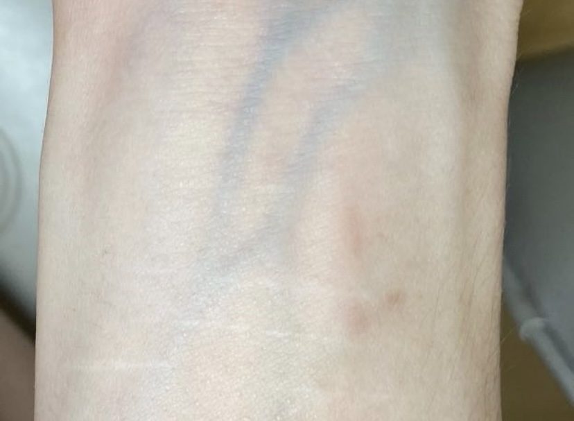 Tattoo after 13 laser tattoo removal sessions at Goodbye Rhonda