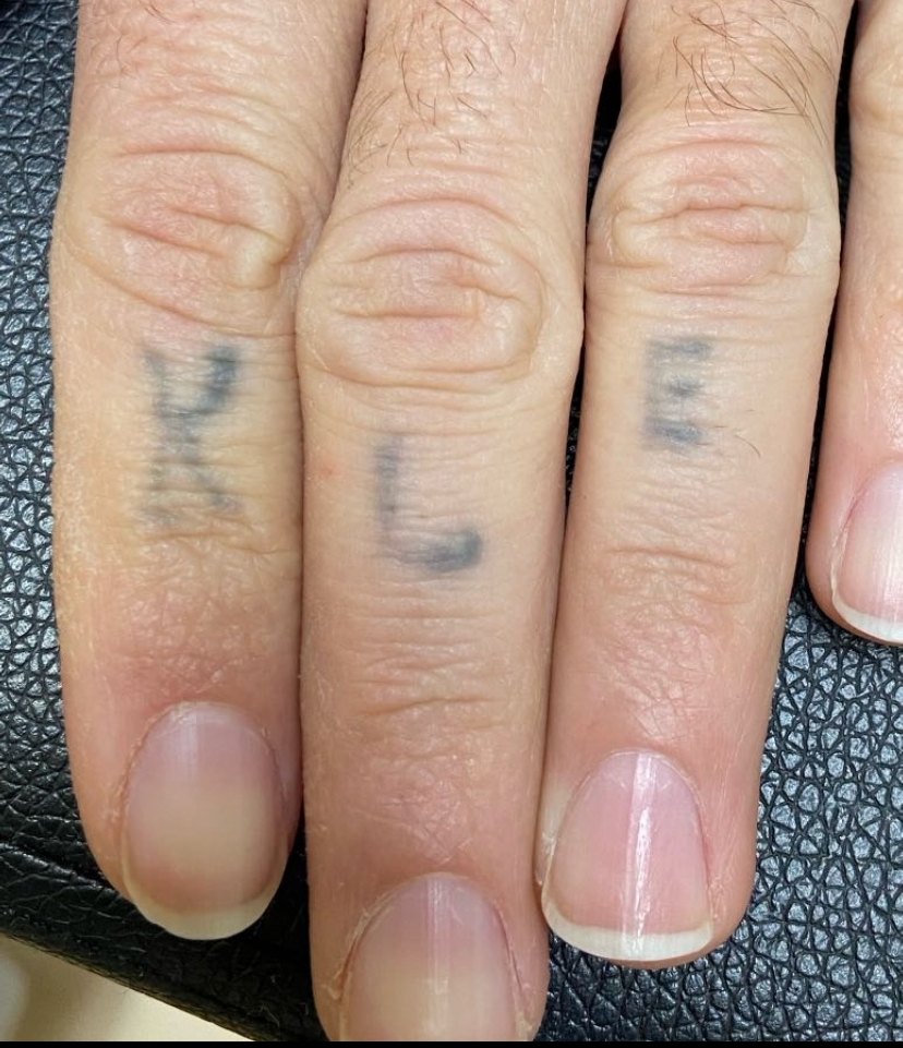 Tattoo before laser tattoo removal at Goodbye Rhonda