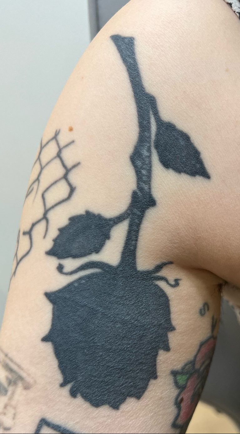 Tattoo before laser tattoo removal at Goodbye Rhonda