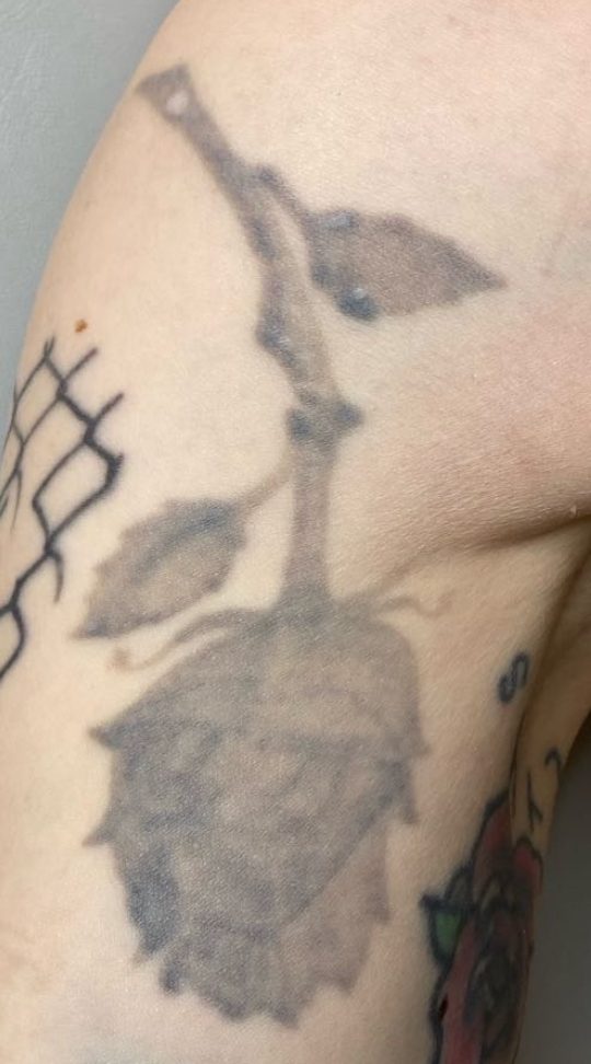 Tattoo after 8 laser tattoo removal sessions at Goodbye Rhonda