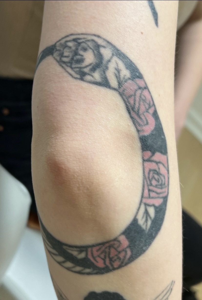 Tattoo before laser tattoo removal at Goodbye Rhonda