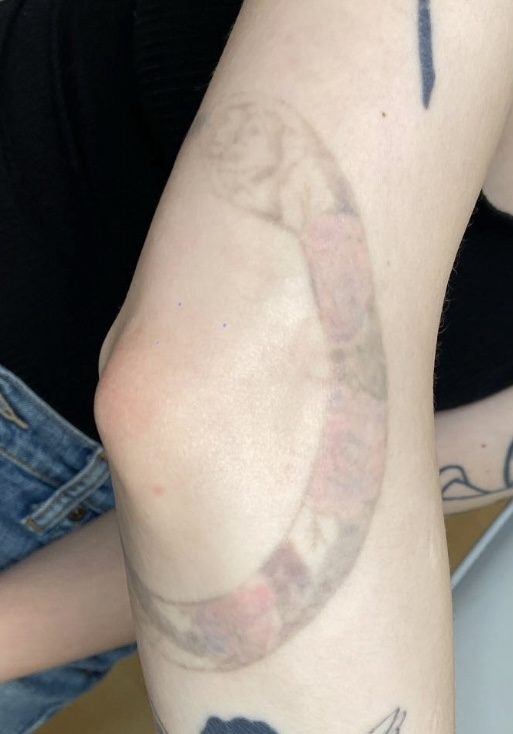 Tattoo after 8 laser tattoo removal sessions at Goodbye Rhonda
