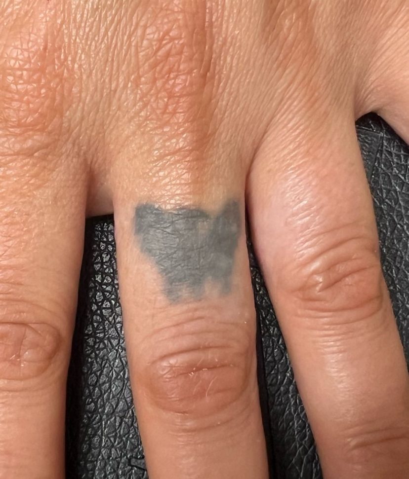 Tattoo before laser tattoo removal at Goodbye Rhonda