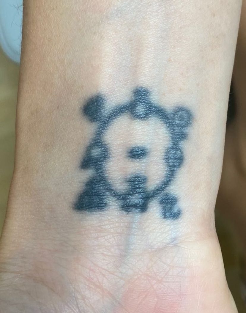 Tattoo before laser tattoo removal at Goodbye Rhonda