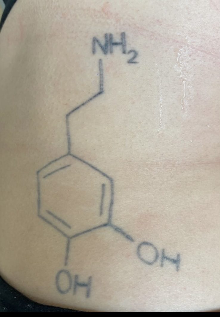 Tattoo before laser tattoo removal at Goodbye Rhonda