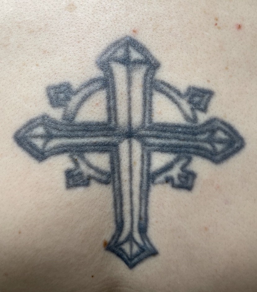 Tattoo before laser tattoo removal at Goodbye Rhonda