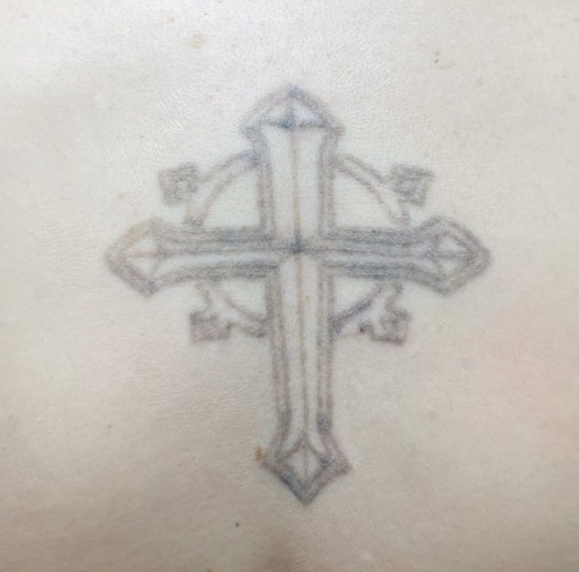 Tattoo after 2 laser tattoo removal sessions at Goodbye Rhonda
