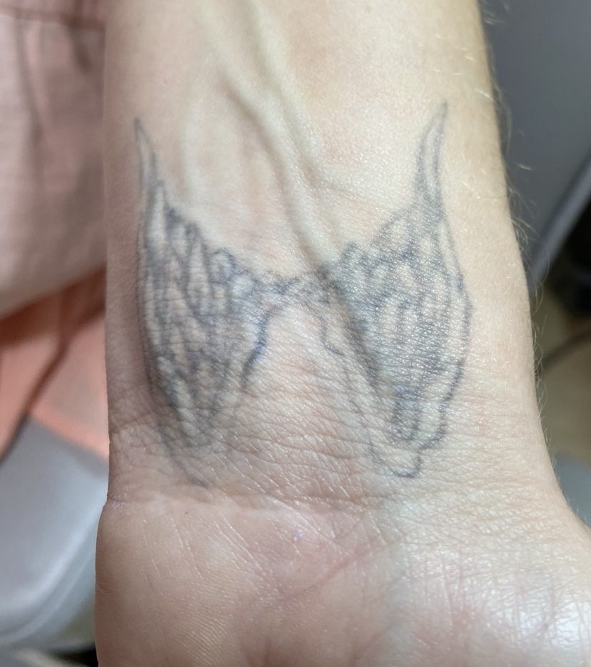 Tattoo before laser tattoo removal at Goodbye Rhonda