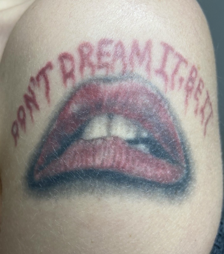 Tattoo before laser tattoo removal at Goodbye Rhonda