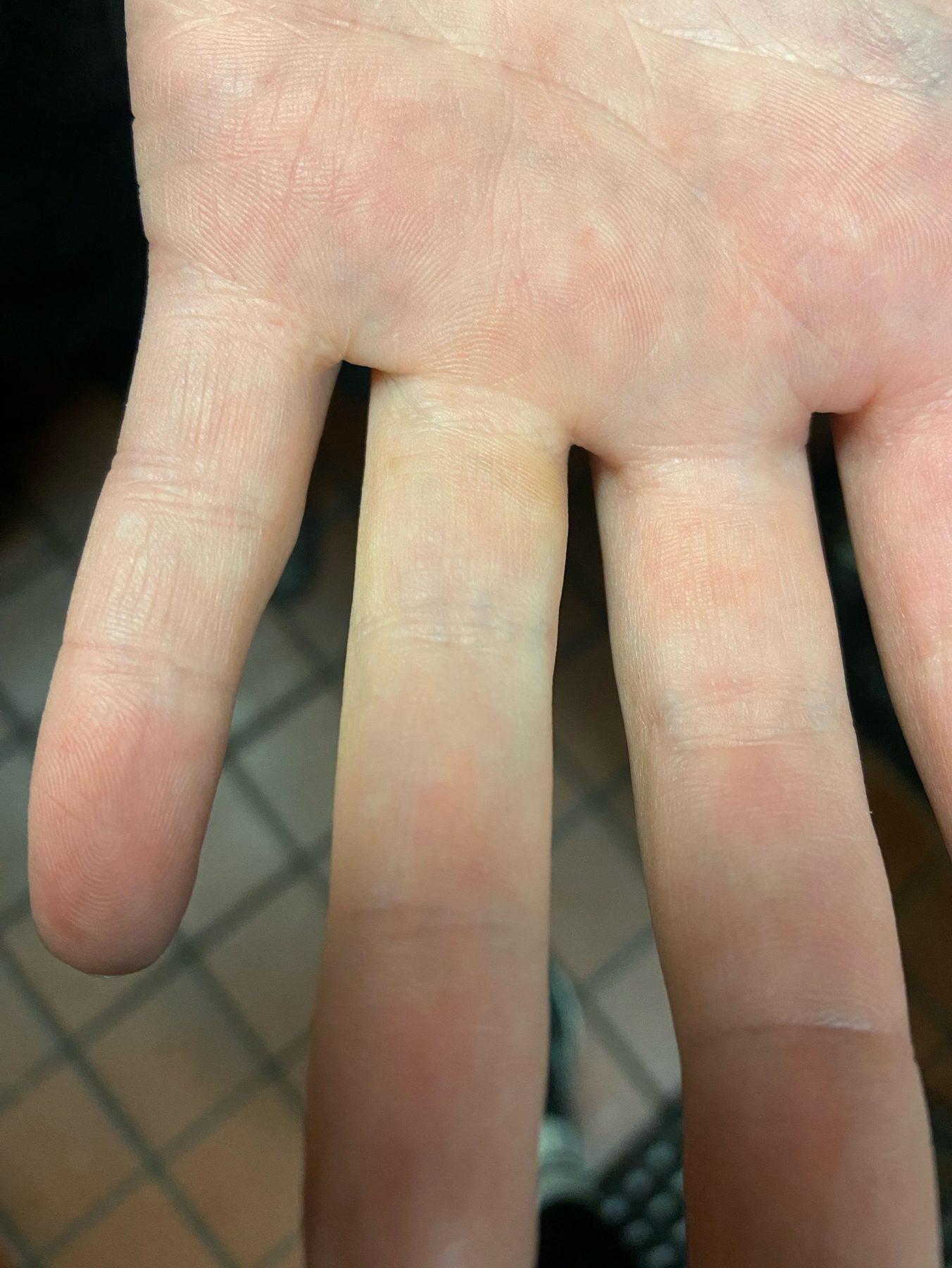 Tattoo after 3 laser tattoo removal sessions at Goodbye Rhonda