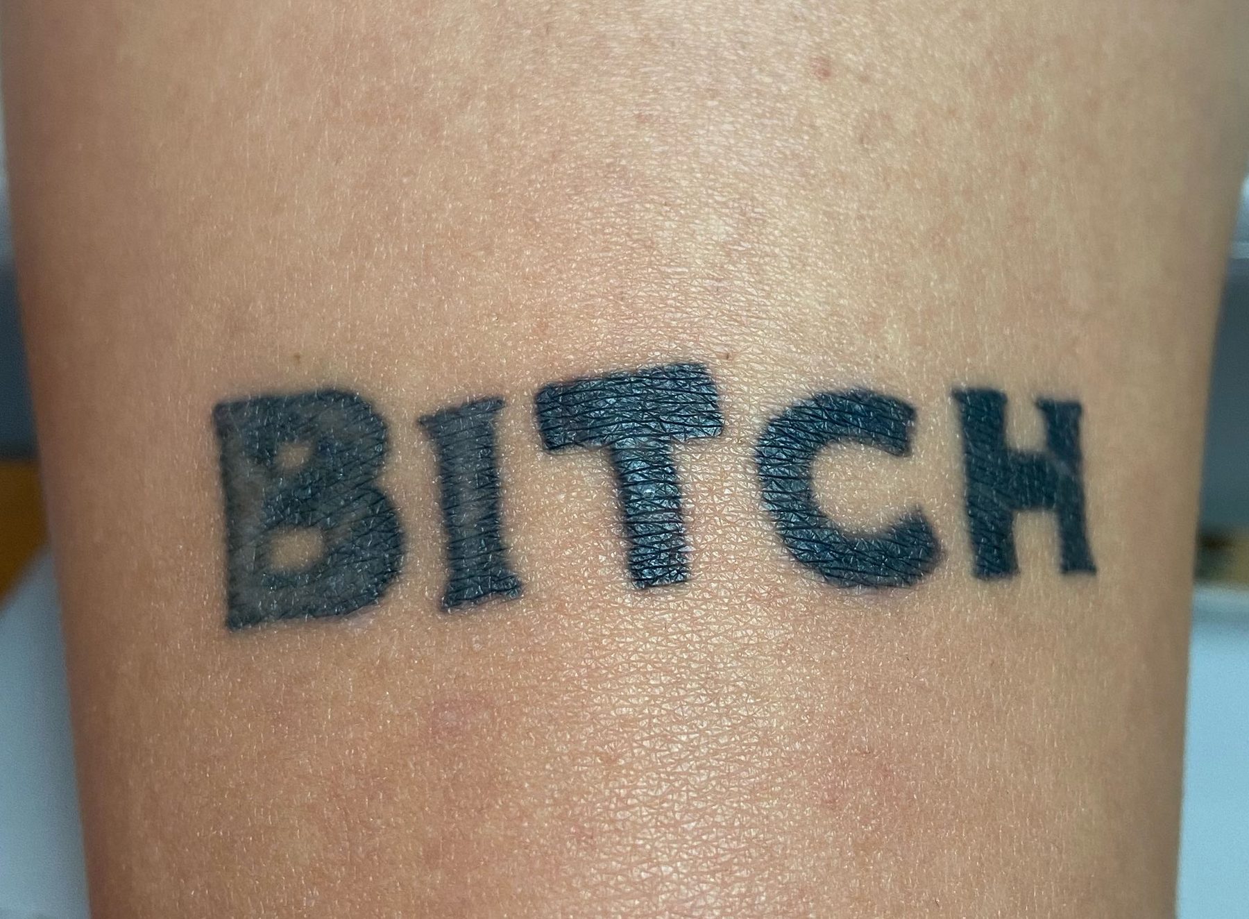Tattoo before laser tattoo removal at Goodbye Rhonda