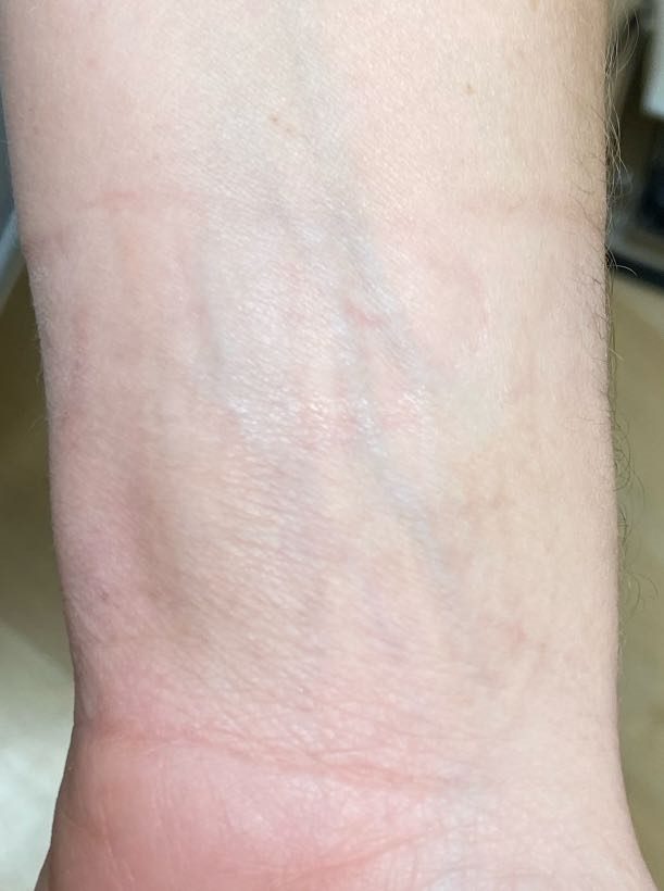 Tattoo after 4 laser tattoo removal sessions at Goodbye Rhonda