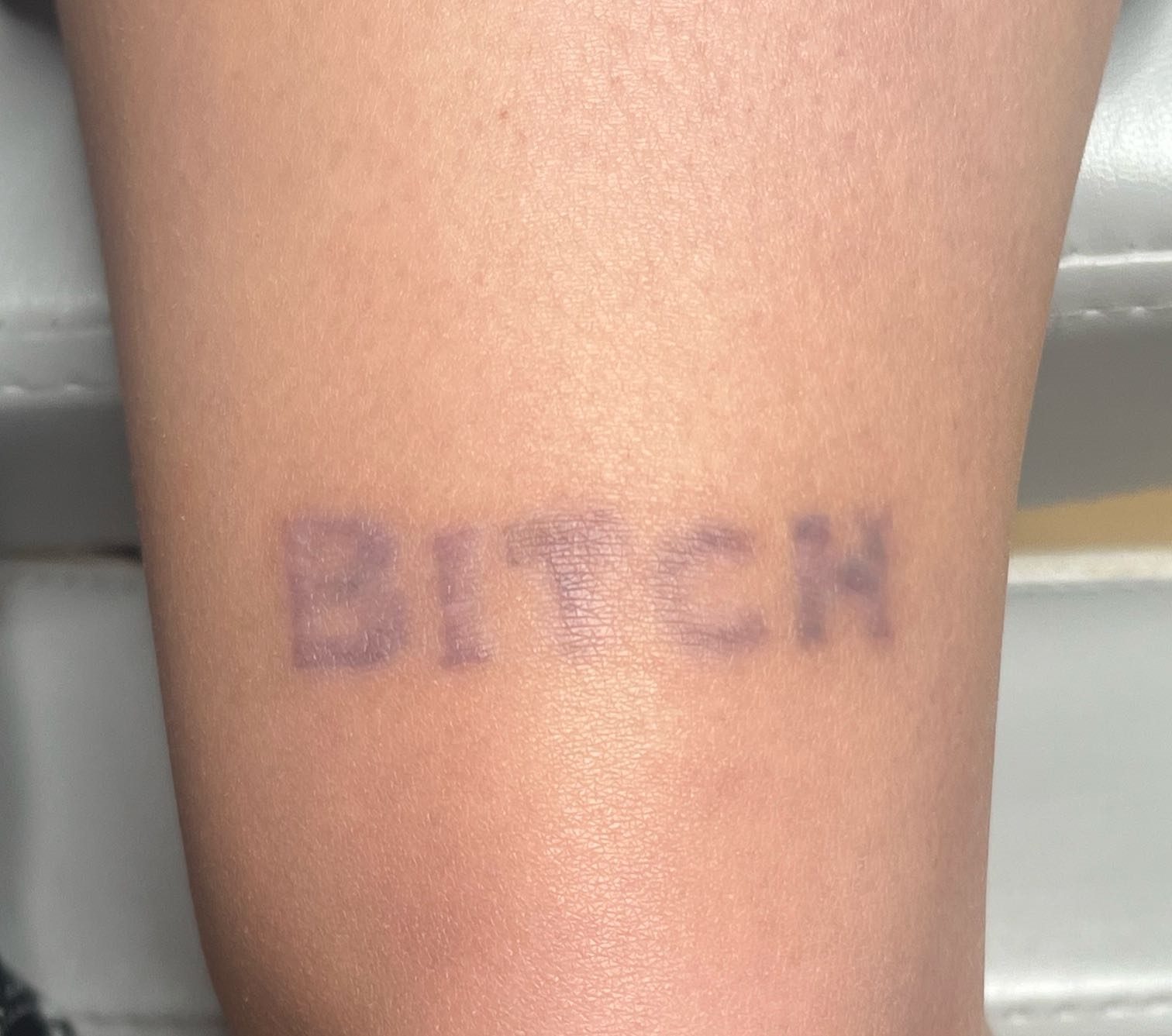 Tattoo after 12 laser tattoo removal sessions at Goodbye Rhonda